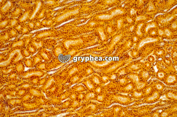 Tubules Rein x40 - gryphea.com